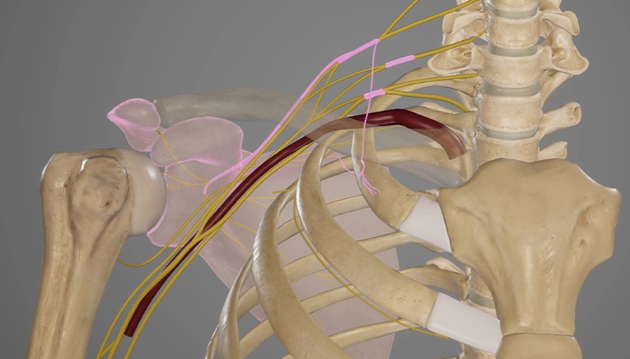 Brachial Plexus Lezyonlarının Sınıflandırılması